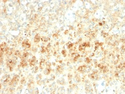 Adipophilin / Perilipin-2 Recombinant Monoclonal Rabbit Antibody (ADFP/2755R)