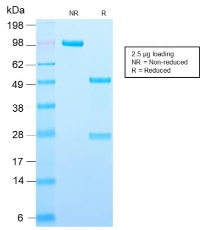 Adipophilin / Perilipin-2 Recombinant Monoclonal Rabbit Antibody (ADFP/2755R)