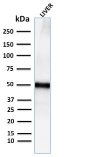 Adipophilin / Perilipin-2 Recombinant Monoclonal Rabbit Antibody (ADFP/2755R)