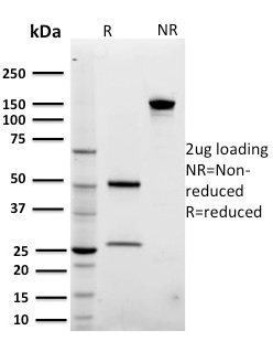 ADP-Ribosylation Factor 1 (ARF1) Monoclonal Mouse Antibody (3F1)