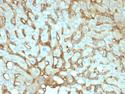 Albumin Monoclonal Mouse Antibody (ALB/2141)
