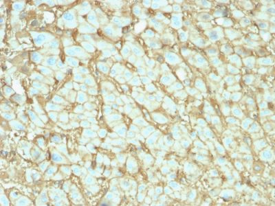 Albumin Monoclonal Mouse Antibody (ALB/2142)