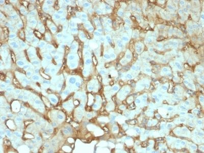 Albumin Monoclonal Mouse Antibody (ALB/2144)
