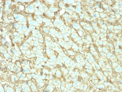 Albumin Monoclonal Mouse Antibody (ALB/2144)