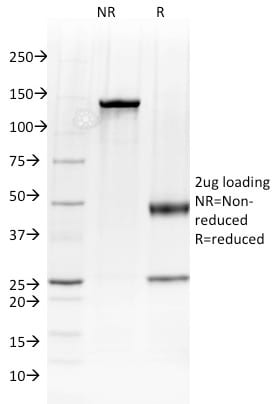 Albumin Monoclonal Mouse Antibody (ALB/2144)