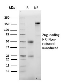 Albumin Monoclonal Mouse Antibody (ALB/2355)