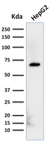 Albumin Monoclonal Mouse Antibody (ALB/2356)