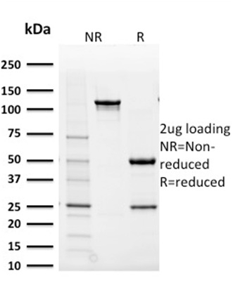 Aldo-keto Reductase Family 1 Member B1 Monoclonal Mouse Antibody (CPTC-AKR1B1-2)