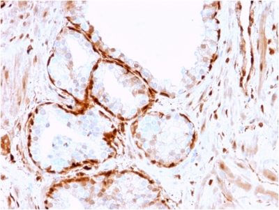 Aldo-keto Reductase Family 1 Member B1 Monoclonal Mouse Antibody (CPTC-AKR1B1-3)