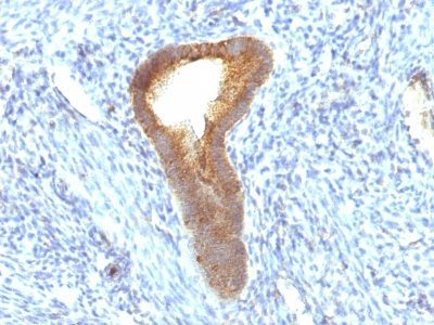 Alkaline Phosphatase Monoclonal Mouse Antibody (ALPL/597)