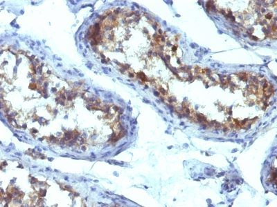 Alkaline Phosphatase Monoclonal Mouse Antibody (ALPL/597)