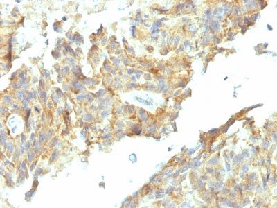 Alkaline Phosphatase Monoclonal Mouse Antibody (ALPL/597)