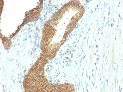 Alkaline Phosphatase Monoclonal Mouse Antibody (ALPL/597)