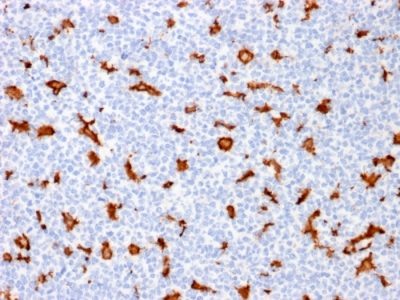 Allograft Inflammatory Factor 1 / IBA1 Monoclonal Mouse Antibody (AIF1/1909)
