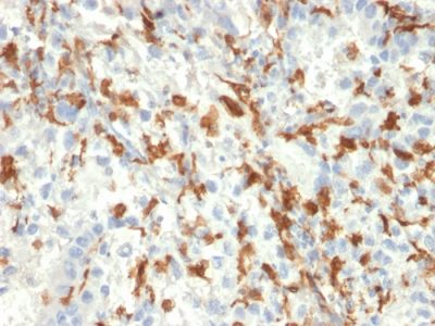 Allograft Inflammatory Factor 1 / IBA1 Monoclonal Mouse Antibody (AIF1/2493)