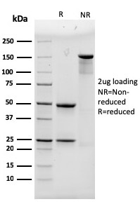 Alpha Actinin 4 Monoclonal Mouse Antibody (93)