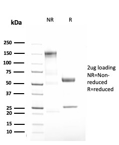 Alpha-1 Antitrypsin Recombinant Monoclonal Rabbit Antibody (AAT/3167R)