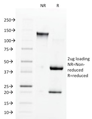 Angiotensin I Converting Enzyme / CD143 Monoclonal Mouse Antibody (9B9)