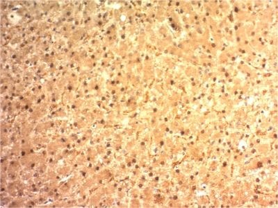 Arginase 1 Monoclonal Mouse Antibody (ARG1/1125)