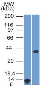 Arginase 1 Monoclonal Mouse Antibody (ARG1/1125)