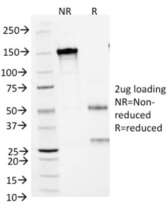 Arginase 1 Monoclonal Mouse Antibody (ARG1/1125)