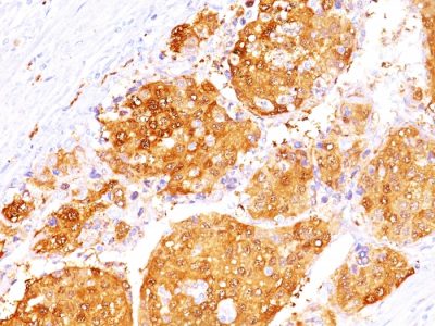 Arginase 1 Monoclonal Mouse Antibody (ARG1/1125+ ARG1/1126)