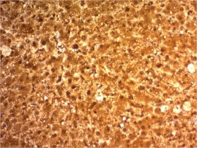 Arginase 1 Monoclonal Mouse Antibody (ARG1/1126)