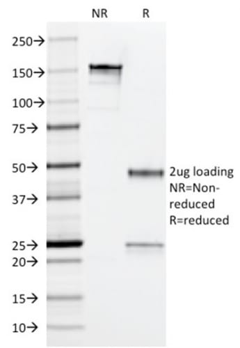 Arginase 1 Monoclonal Mouse Antibody (ARG1/1126)