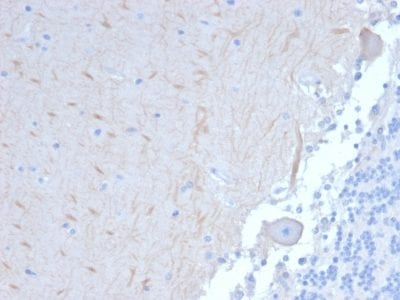Autophagy Protein 5 (ATG5) Monoclonal Mouse Antibody (ATG5/2101)