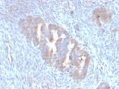 Autophagy Protein 5 (ATG5) Monoclonal Mouse Antibody (ATG5/2101)