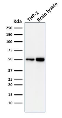 Autophagy Protein 5 (ATG5) Monoclonal Mouse Antibody (ATG5/2101)