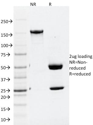 Autophagy Protein 5 (ATG5) Monoclonal Mouse Antibody (ATG5/2101)