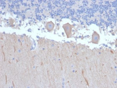 Autophagy Protein 5 (ATG5) Monoclonal Mouse Antibody (ATG5/2492)