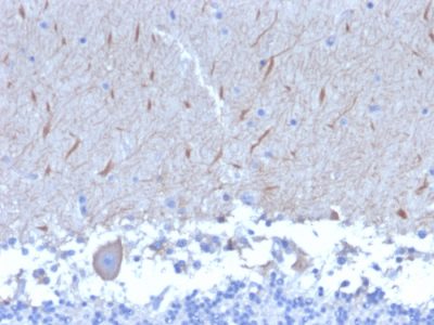 Autophagy Protein 5 (ATG5) Monoclonal Mouse Antibody (ATG5/2553)