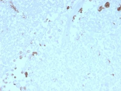 Autophagy Protein 5 (ATG5) Recombinant Monoclonal Mouse Antibody (rATG5/2553)