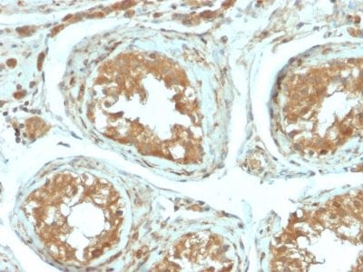 B7-H4 Recombinant Monoclonal Rabbit Antibody (B7H4/2652R)