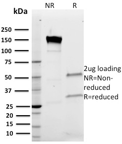 Band 3 Monoclonal Mouse Antibody (Q1/156)