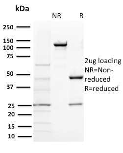 BAP1 Monoclonal Mouse Antibody (BAP1/2431)