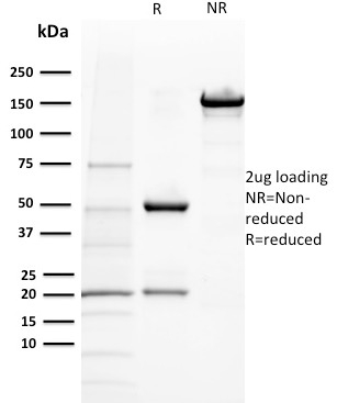 BAP1 Monoclonal Mouse Antibody (BAP1/2432)