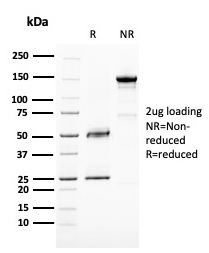 BAP1 Monoclonal Mouse Antibody (BAP1/2667)