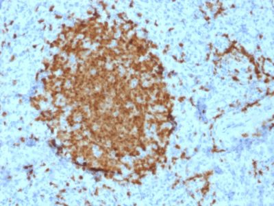 BOB-1 Monoclonal Mouse Antibody (BOB1/2421)