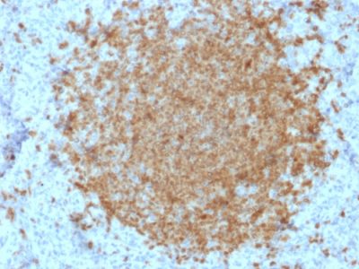 BOB-1 Monoclonal Mouse Antibody (BOB1/2422)