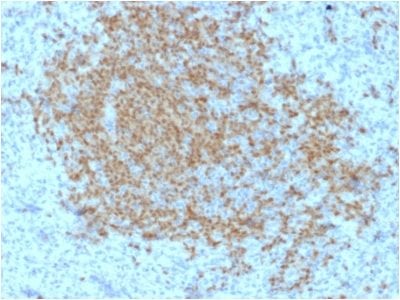 BOB-1 Monoclonal Mouse Antibody (BOB1/2423)