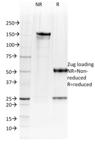 BOB-1 Monoclonal Mouse Antibody (BOB1/2423)
