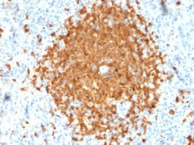 BOB-1 Monoclonal Mouse Antibody (BOB1/2424)
