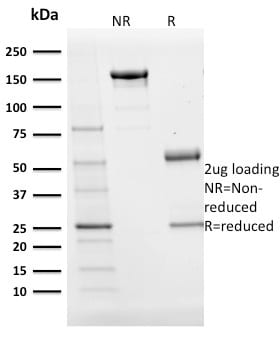 BOB-1 Monoclonal Mouse Antibody (BOB1/2424)