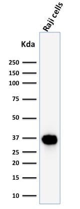 BOB-1 Monoclonal Mouse Antibody (BOB1/2425)