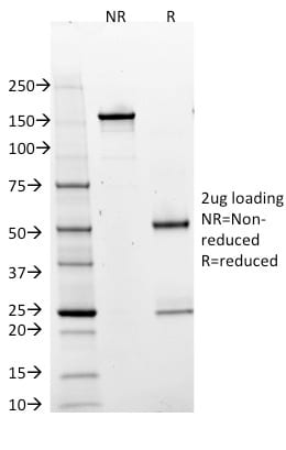 BOB-1 Monoclonal Mouse Antibody (BOB1/2425)
