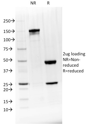 BTLA / CD272 Monoclonal Mouse Antibody (BTLA/1528)