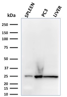 C1QA / Complement C1q A-Chain Monoclonal Mouse Antibody (C1QA/2783)